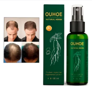 Spray para caida de cabello