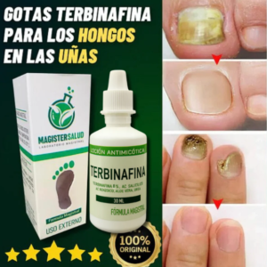 Anti hongo terbinafina